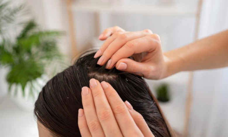 Beyond the Flakes: A Comprehensive Guide to Choosing Anti Dandruff Shampoo HK Locals Can Trust