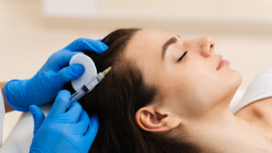 StemGen Pro PRP: Hair Restoration in 2026