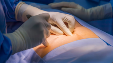 Premier Hernia Surgeon