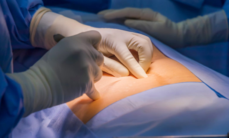 Premier Hernia Surgeon