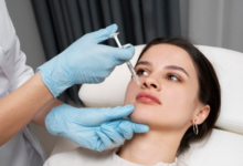 Sculptra vs Traditional Fillers: Which Facial Rejuvenation Treatment Lasts Longer?