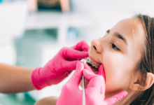 What Happens When a Tooth Is Lost During Orthodontic Treatment? 