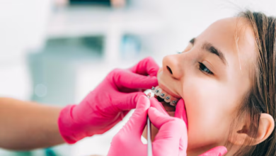 What Happens When a Tooth Is Lost During Orthodontic Treatment? 