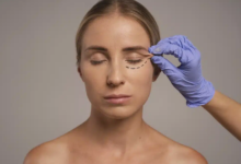 Eyelid Surgery and Informed Patient Decisions