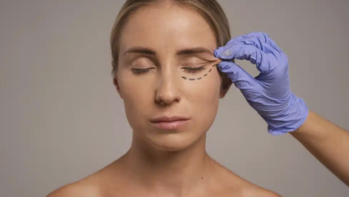 Eyelid Surgery and Informed Patient Decisions
