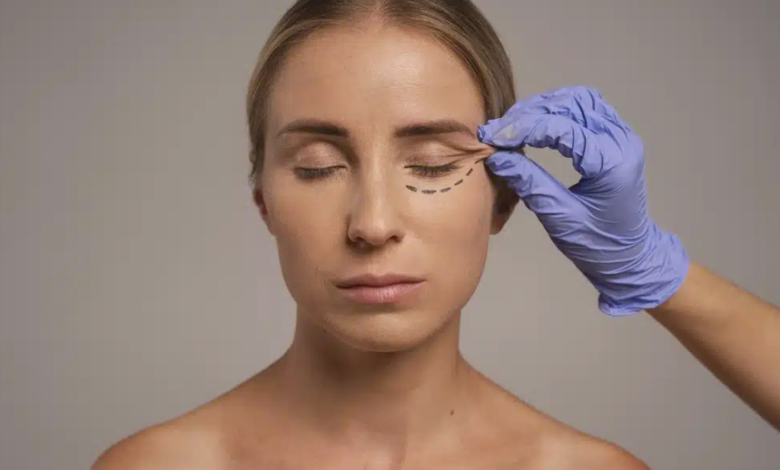 Eyelid Surgery and Informed Patient Decisions
